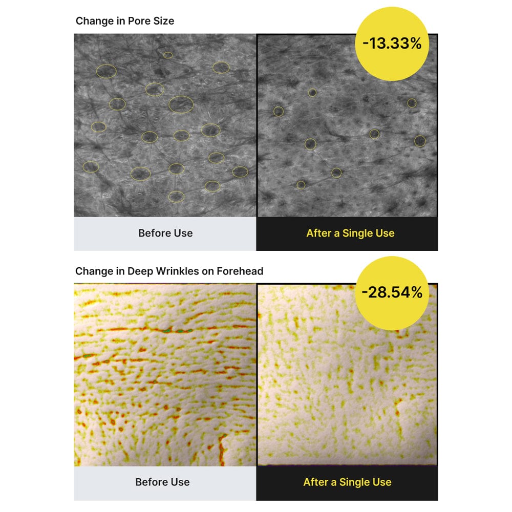 Celimax The Vita A Retinal Shot Tightening Booster